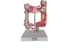 Peana 3D colon